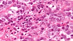 Biomarkers group