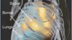 Three-dimensional rendering of bones, skin and lung based on XCT data and FMT reconstruction Three-dimensional rendering of bones, skin and lung based on XCT data and FMT reconstruction