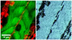 Results of Hybrid optical & optoacoustic imaging 