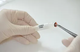 Putting a sample into a cryo vial (Photo: kfbfotografie)
