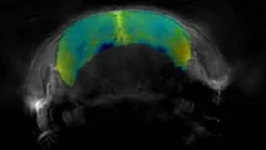 Oxygenation map of mouse brain