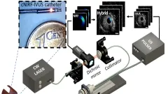 The cNIRF-IVUS imaging system for intravascular through-blood imaging. The cNIRF-IVUS imaging system for intravascular through-blood imaging.