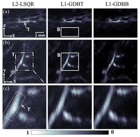 (a-b) MIP results of the L2-LSQR, L1-GDBT and L1-GDBB reconstructions form side and top view. (a-b) MIP results of the L2-LSQR, L1-GDBT and L1-GDBB reconstructions form side and top view.