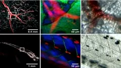 Hybrid optoacoustic and multiphoton imaging of a mouse ear and a zebrafish larva ex-vivo. 