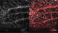 Results of Raster-Scan Optoacoustic Mesoscopy (mouse ear)