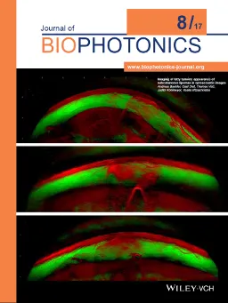 Journal of Biophotonics, Volume 10, Issue 8 Journal of Biophotonics, Volume 10, Issue 8