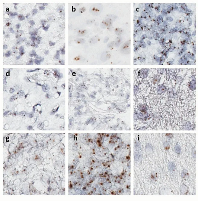 RNAScope Analyse der der LGR5 mRNA Expression