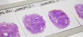 Unsere Diagnostik (copyright Pathologie 2010)