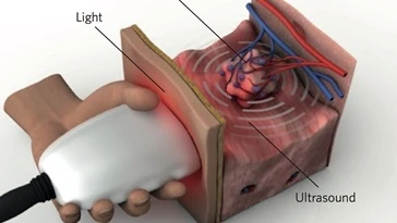 Beispiel eines tragbaren MSOT-Geräts